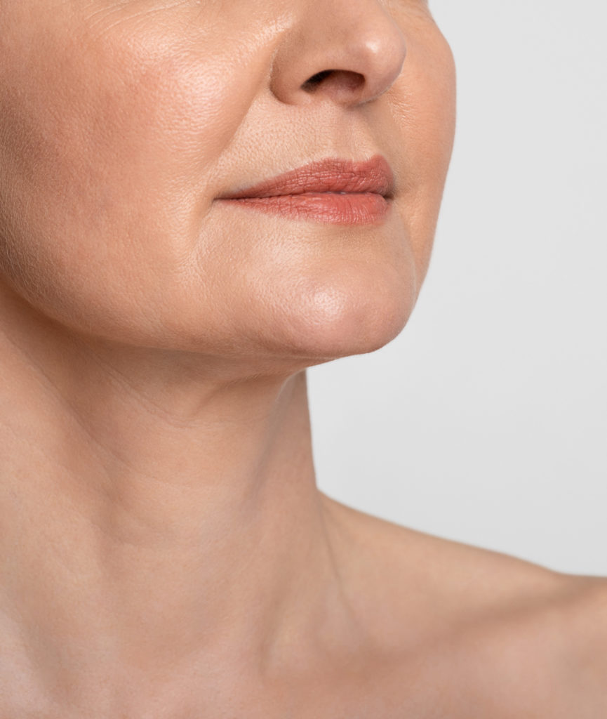 Closeup on woman's chin and neck.