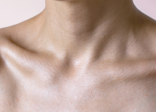 Decolletage Treatment