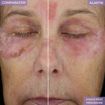 An all-in-one procedure enhancement system is designed to help prepare skin and accelerate results when used before and after cosmetic treatments.