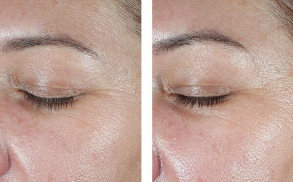 EyeMax AlphaRet Overnight Cream - Image 4
