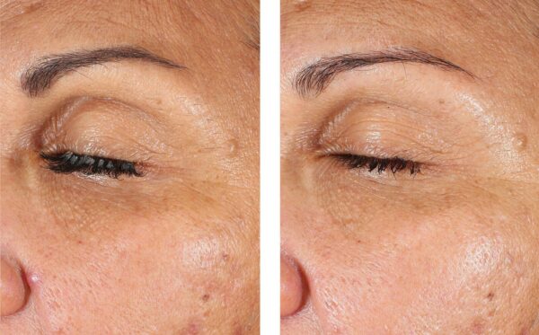 EyeMax AlphaRet Overnight Cream - Image 3