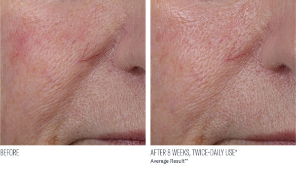 InterFuse Treatment Cream FACE & NECK - Image 6