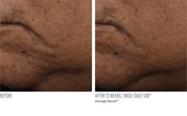 InterFuse Treatment Cream FACE & NECK - Image 3