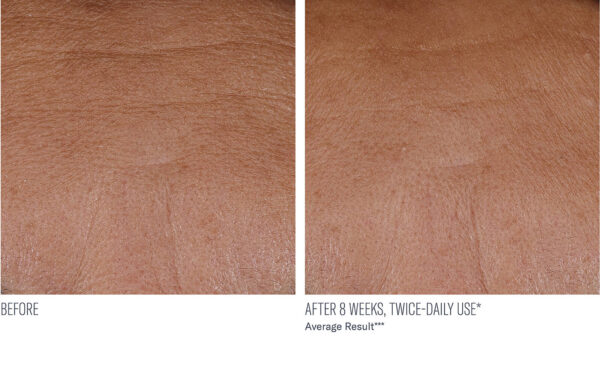 InterFuse Treatment Cream FACE & NECK - Image 5