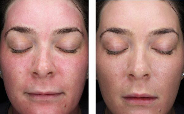 Sunbetter TONE SMART SPF 68 Sunscreen Compact - Image 4