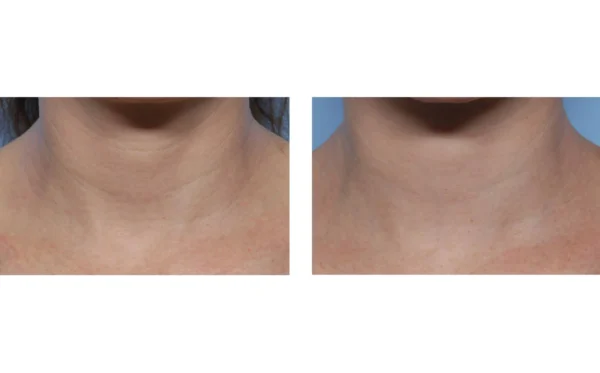 Techno Neck Perfecting Cream - Image 4