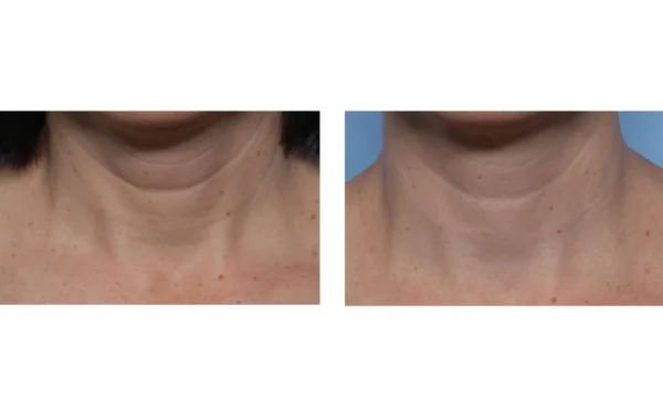 Techno Neck Perfecting Cream - Image 3