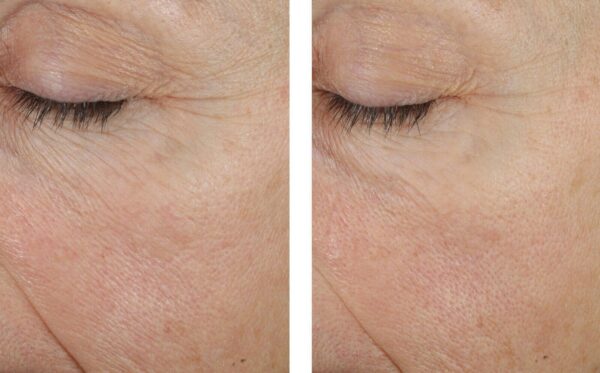 Trio Rebalancing Moisture Treatment - Image 3