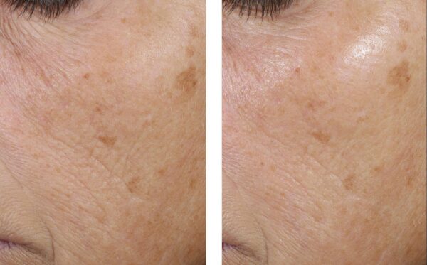 Skin that is dry and compromised, heavy hydration without the weight.