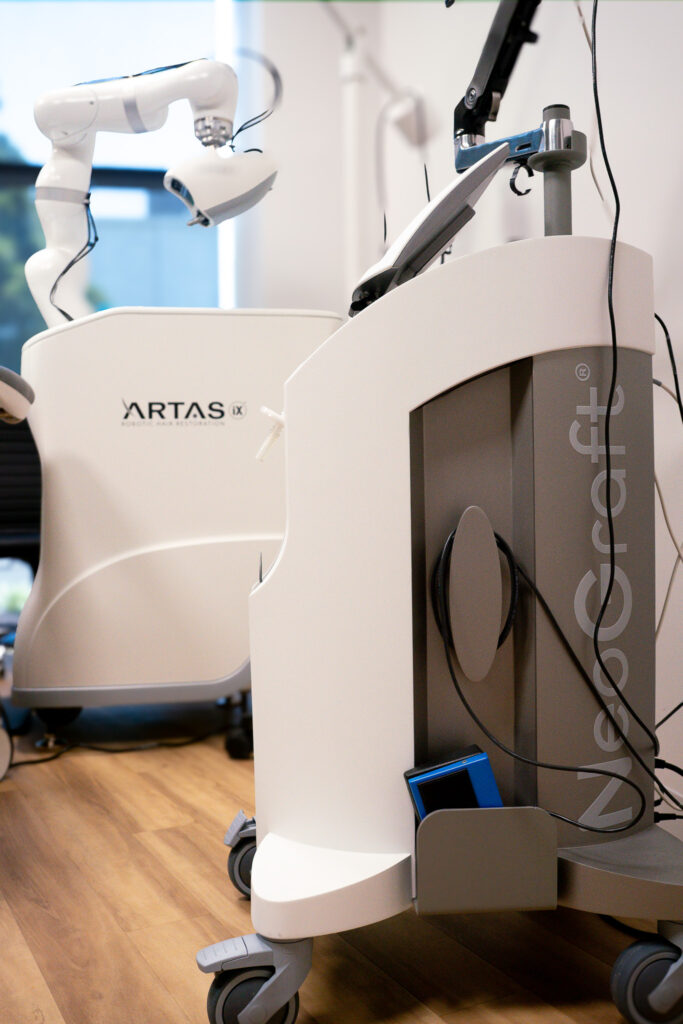 FUE hair transplant in virginia beach