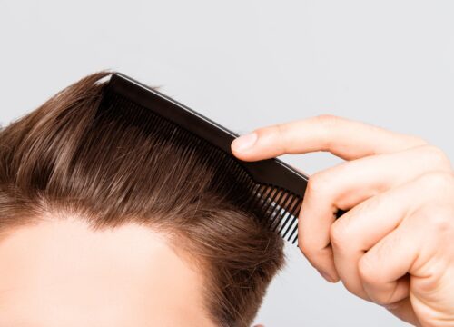 Neograft® Hair Transplants